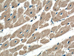 ATG9A Antibody in Immunohistochemistry (Paraffin) (IHC (P))