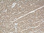 ATG9A Antibody in Immunohistochemistry (Paraffin) (IHC (P))