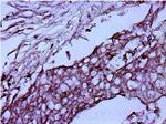 Mouse IgG (H+L) Secondary Antibody in Immunohistochemistry (Paraffin) (IHC (P))