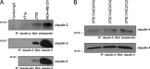 Claudin 2 Antibody in Western Blot, Immunoprecipitation (WB, IP)