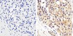 Phospho-STAT1 (Tyr701) Antibody in Immunohistochemistry (Paraffin) (IHC (P))