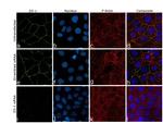 ZO-1 Antibody in Immunocytochemistry (ICC/IF)