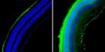 Mouse IgG (H+L) Secondary Antibody in Immunohistochemistry (Paraffin) (IHC (P))