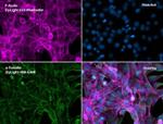 Mouse IgG (H+L) Secondary Antibody in Immunocytochemistry (ICC/IF)