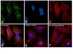 Mouse IgG (H+L) Cross-Adsorbed Secondary Antibody in Immunocytochemistry (ICC/IF)