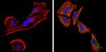 Rabbit IgG (H+L) Secondary Antibody in Immunocytochemistry (ICC/IF)