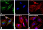 Rabbit IgG (H+L) Cross-Adsorbed Secondary Antibody in Immunocytochemistry (ICC/IF)