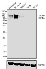 CD146 Antibody