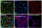 beta Amyloid Antibody