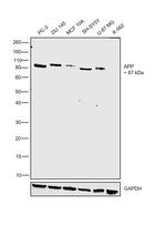 beta Amyloid Antibody in Western Blot (WB)