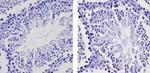 EZH2 Antibody in Immunohistochemistry (Paraffin) (IHC (P))