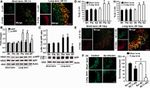 beta Amyloid Antibody in Western Blot (WB)