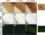 beta Amyloid Antibody in Immunohistochemistry - Free Floating (IHC (Free))