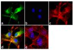 beta Amyloid Antibody in Immunocytochemistry (ICC/IF)