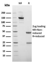 Cytokeratin 10 Antibody in SDS-PAGE (SDS-PAGE)