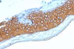 Cytokeratin 10 (KRT10) (Suprabasal Epithelial Marker) Antibody in Immunohistochemistry (Paraffin) (IHC (P))