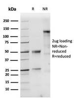 Cytokeratin 10 Antibody in SDS-PAGE (SDS-PAGE)