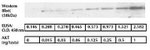 Human AKT (Total) ELISA Kit