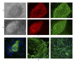 TRA-1-60 Antibody in Immunocytochemistry (ICC/IF)