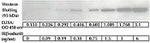 Human IR beta ELISA Kit