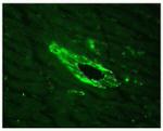 alpha Actinin 4 Antibody in Immunohistochemistry (IHC)