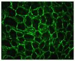 alpha Actinin 4 Antibody in Immunohistochemistry (IHC)