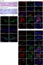 VGLUT2 Antibody in Immunocytochemistry (ICC/IF)