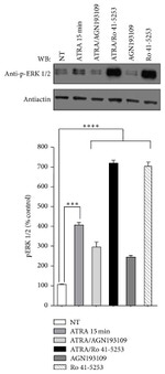 Phospho-ERK1/ERK2 (Thr185, Tyr187) Antibody in Western Blot (WB)