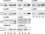 Phospho-Tau (Ser404) Antibody in Western Blot (WB)