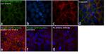 Phospho-EGFR (Tyr992) Antibody in Immunocytochemistry (ICC/IF)