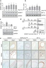 Phospho-EGFR (Tyr1068) Antibody in Immunohistochemistry (IHC)