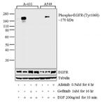 Phospho-EGFR (Tyr1068) Antibody in Western Blot (WB)