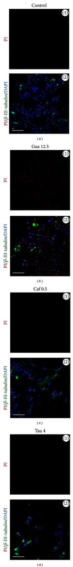 beta Tubulin Antibody in Immunocytochemistry (ICC/IF)