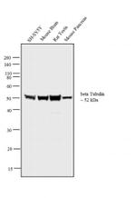 beta Tubulin Antibody in Western Blot (WB)