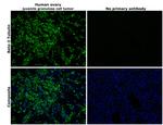 beta Tubulin Antibody in Immunohistochemistry (Paraffin) (IHC (P))