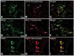 CD3 Antibody in Immunohistochemistry (IHC)