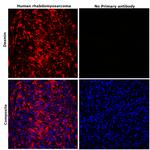 Desmin Antibody in Immunohistochemistry (Paraffin) (IHC (P))