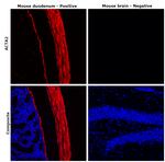 Desmin Antibody