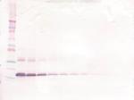 TNFR1 (soluble) Antibody in Western Blot (WB)