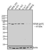 NFkB p65 Antibody in Western Blot (WB)