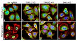 NFkB p65 Antibody