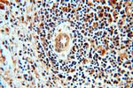 STAT6 Antibody in Immunohistochemistry (Paraffin) (IHC (P))