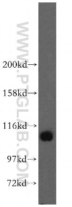 STAT6 Antibody in Western Blot (WB)