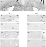 beta Amyloid Antibody in Immunohistochemistry (IHC)