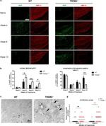 beta Amyloid Antibody in Immunohistochemistry (IHC)