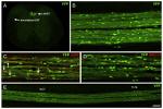 beta Amyloid Antibody in Immunohistochemistry (IHC)