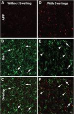 beta Amyloid Antibody in Immunohistochemistry (IHC)