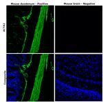 Alpha-Smooth Muscle Actin Antibody in Immunohistochemistry (Paraffin) (IHC (P))