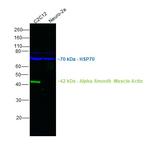 Alpha-Smooth Muscle Actin Antibody