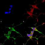 Leucine-Rich Repeat Kinase 2 (LRRK2) Antibody in Immunocytochemistry (ICC/IF)